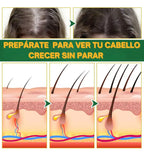OUHOE I Control de Caída y Crecimiento de Cabello